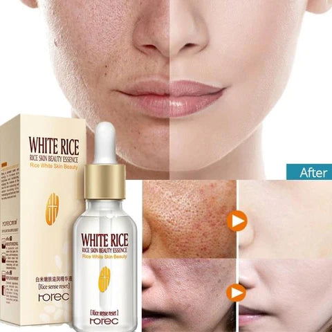 Rorec Moisturizing Anti Wrinkle Rice Face Serum for Open Pores 15ml